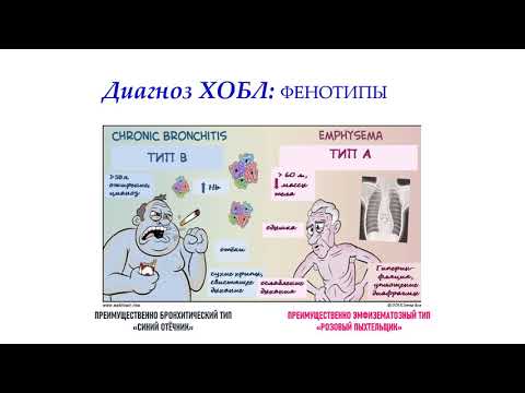 Современные аспекты диагностики и лечения ХОБЛ