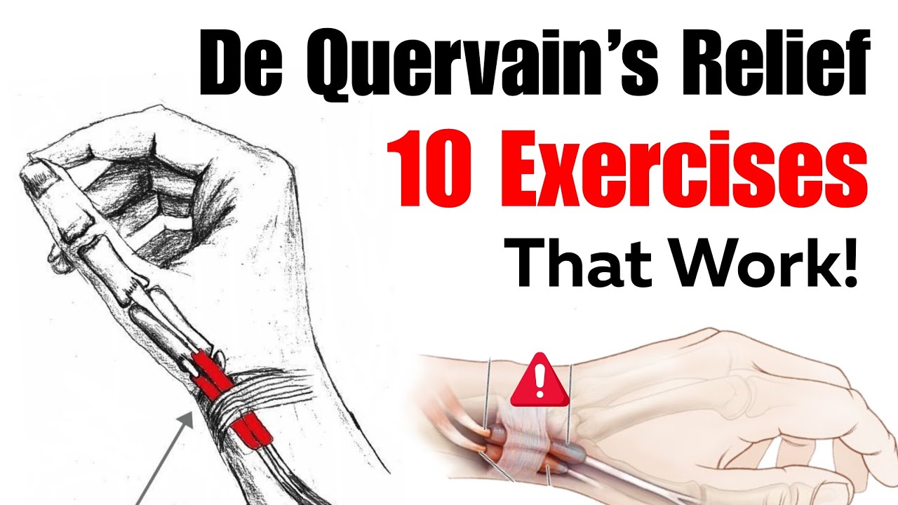 10 лучших упражнений при тендовагините Декервена / боли в большом пальце.