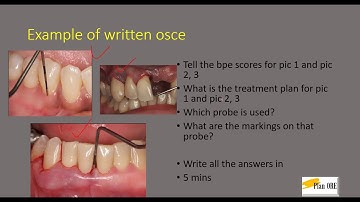 OSCE: Introduction: part 1 (written osce)(ORE PART 2)