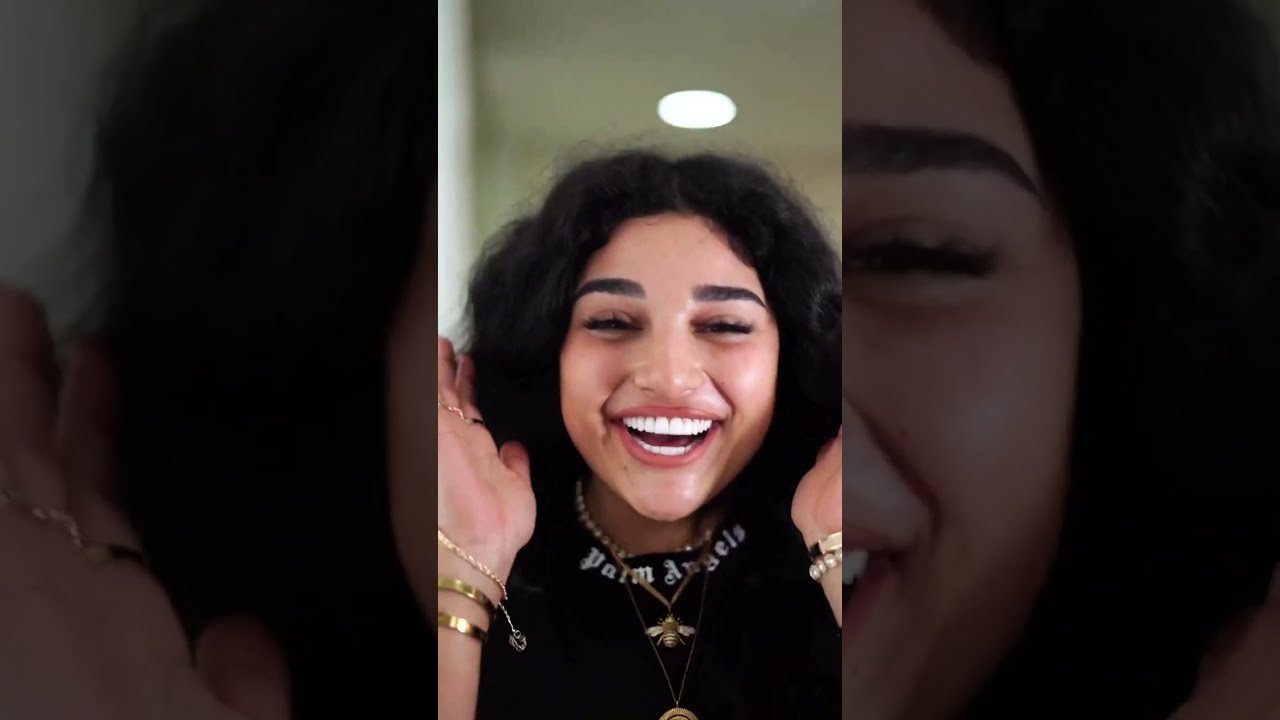 Smile Makeover by Dental Design Turkey