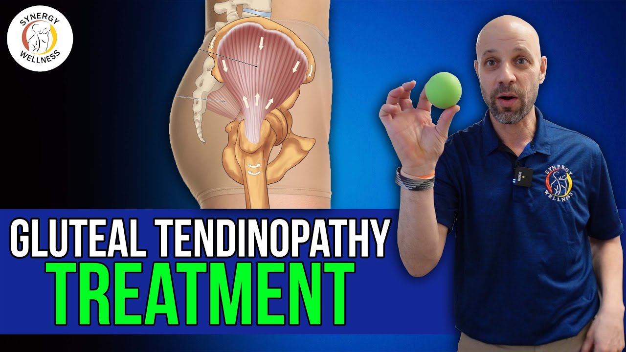 Лечение тендинопатии ягодичных мышц