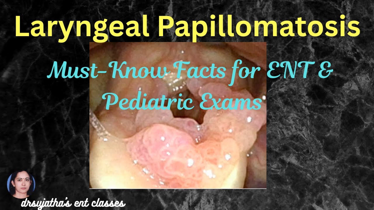 273. Clinical Diagnosis of Laryngeal Papillomatosis (RRP): What Medical ...