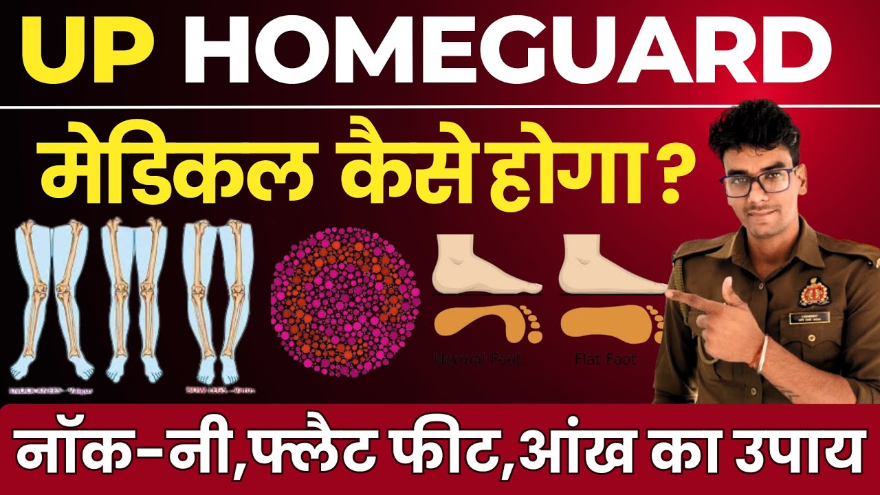 UP Homeguard Medical | Medical Checkup | मेडिकल में दिक्कत कैसे आती है?Home Guard Bharti 2025