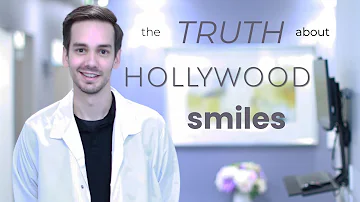 ¿Qué es Hollywood smile teeth?