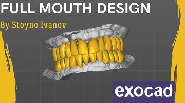 Fastest Exocad Video Tutorial -  Upper & Lower Arch Framework On Implants under 25minutes