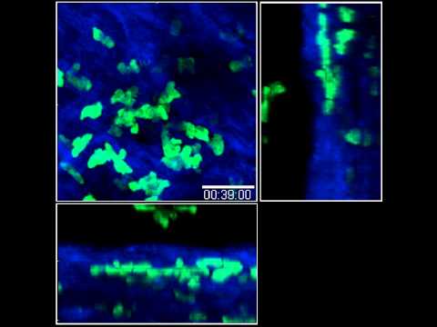 Movie 15: Sequential migration of neutrophils from the epidermis/dermis into sites of sand fly...