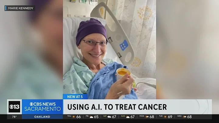 Can AI be used to treat cancer patients? New study aims to find out