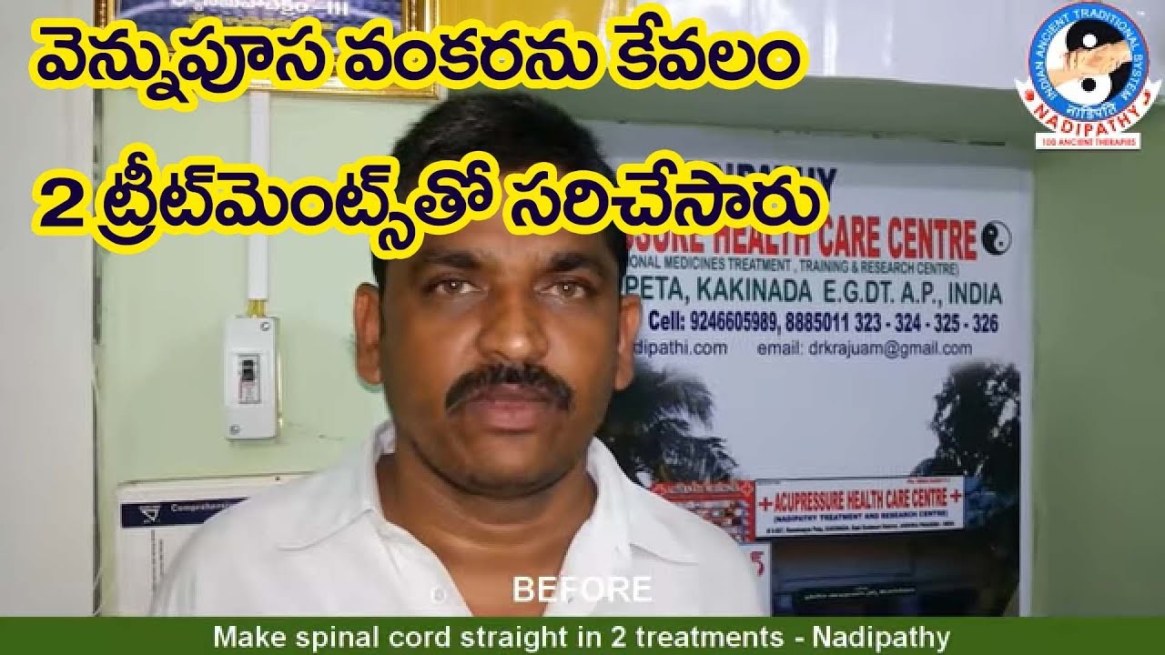 Make spinal cord straight in 2 treatments Nadipathy YouTube