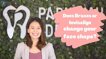 Does Invisalign change your face?