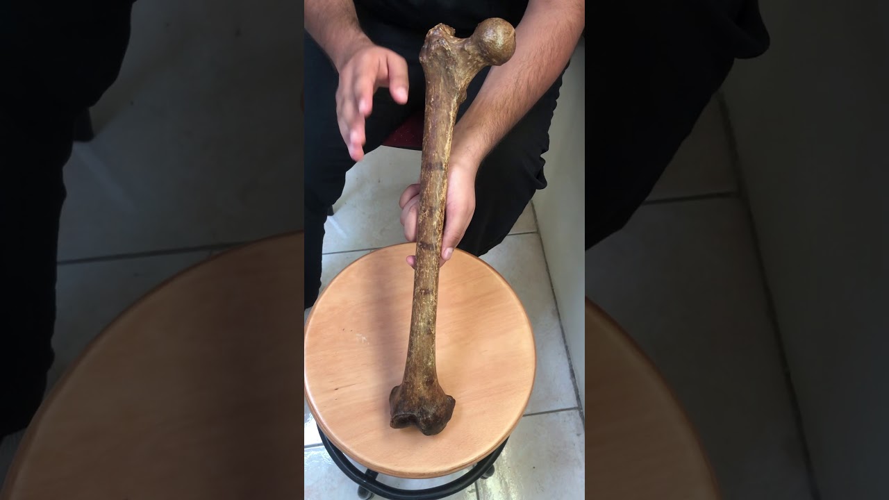 Anatomy of femur bone.