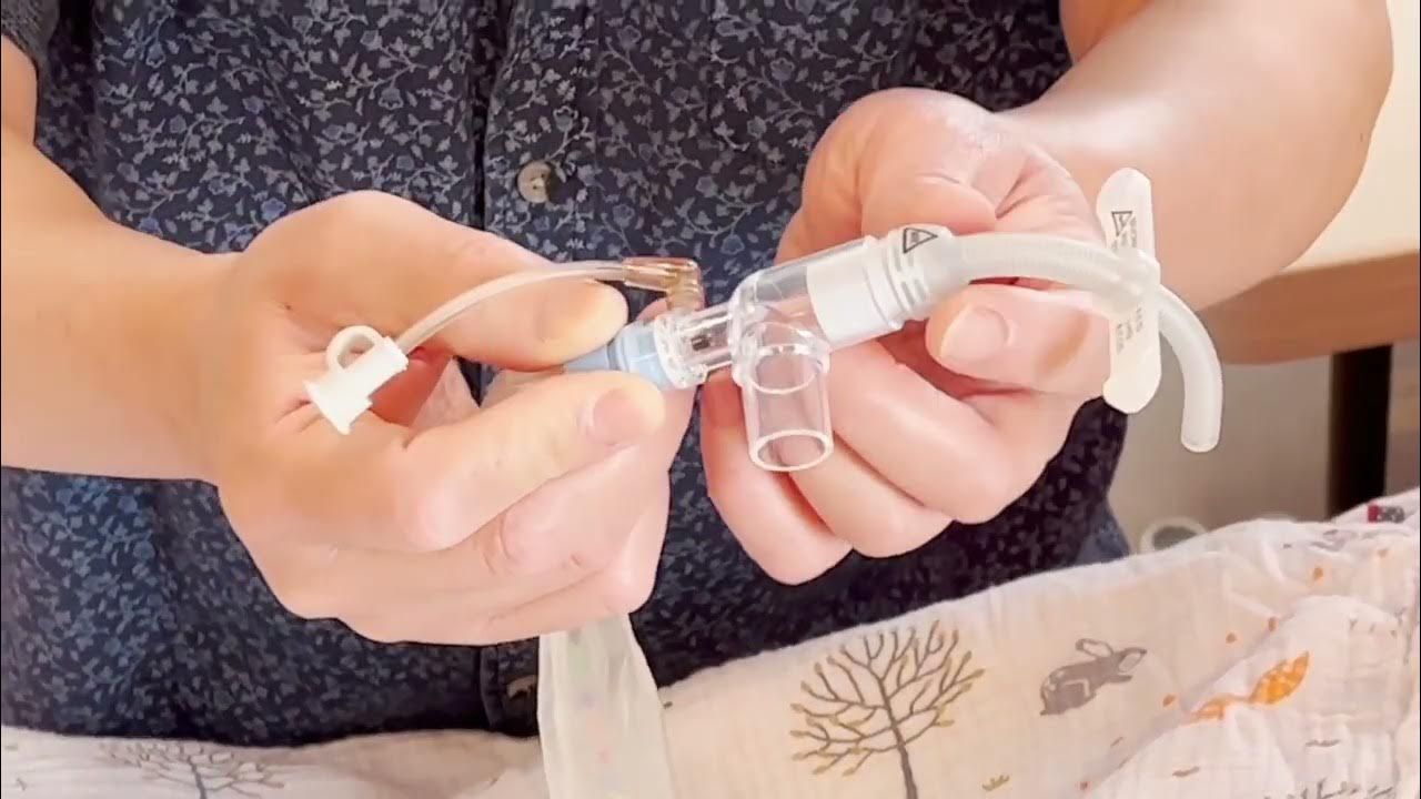 Complete Demo of Tracheostomy Inline Suctioning YouTube