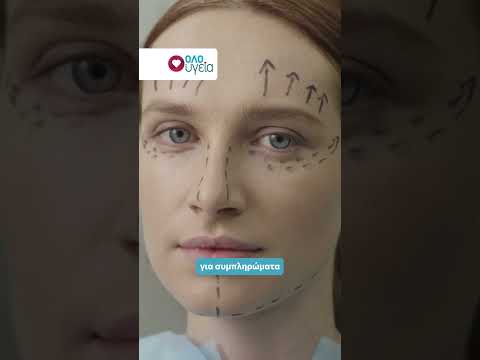 Μπότοξ: Πόσο καιρό χρειάζεται για να δράσει και πόσο διαρκεί