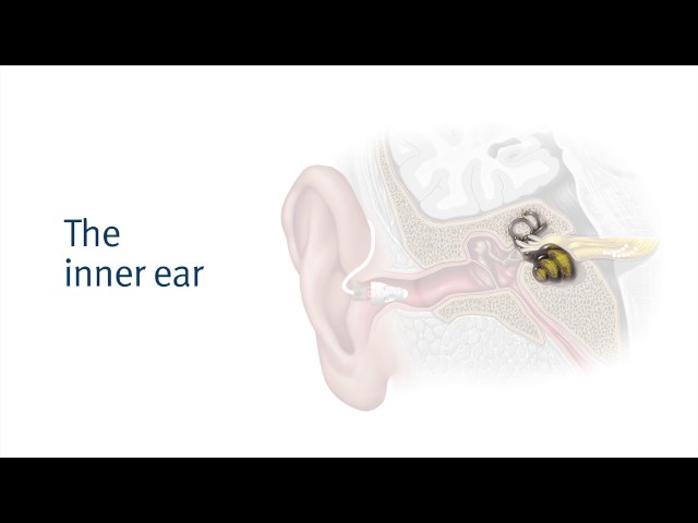 Aided Hearing Loss