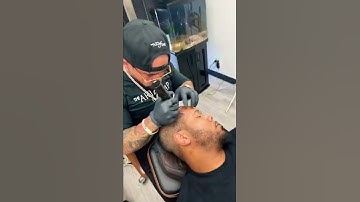 Scalp Micropigmentation in Action