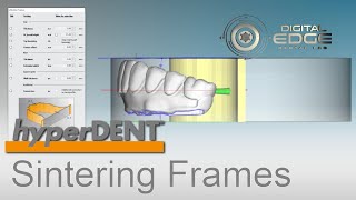 hyperDENT Tutorial Time Saving Tip: Editing Sintering Frames