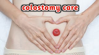 كيفية الرعاية بعملية تحويل المسار_colostomy care