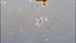Granuloreticulopodia - Pseudopidial Network
Granular streaming pseudopodia of a freshwater Amoeba or naked Foraminifera from Lumpini Park, Bangkok, Thailand. Granuloreticulopodia - Pseudopidial Network