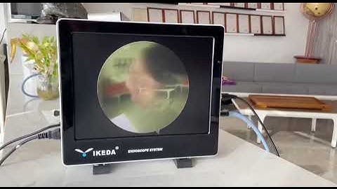 YKD-9115 SD Endoscopy Camera system