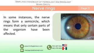 Nerve rings  | Simplified iridology by Maria Grote What Causes Nerve Rings In Eyes