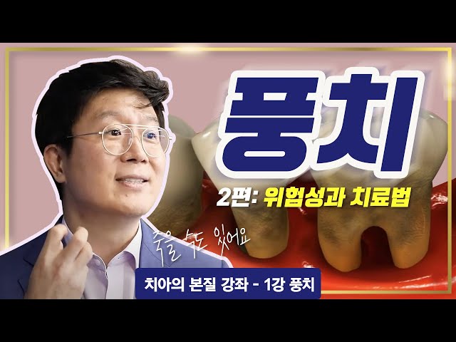 풍치, 방치하면 정말 위험할 수 있다!ㅣ풍치 강좌-2편