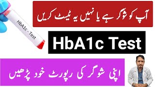 What is HbA1c Test Urdu Hindi- Normal Range of HbA1c Test kya hota hai - Irfan Azeem
