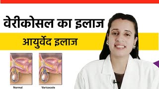 Types of Varicocele.| कारण और इलाज | Ayurvedic Treatment | Varicocele. Pain - Dr. Neha Joshi #njcc