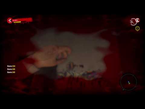 Dead Island - Епаные Лаги