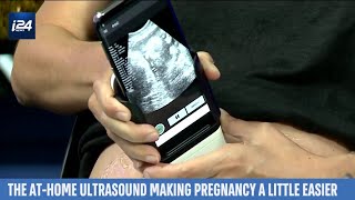 At-Home Ultrasound Lets Pregnant Mothers Monitor Babies by Smartphone screenshot 4
