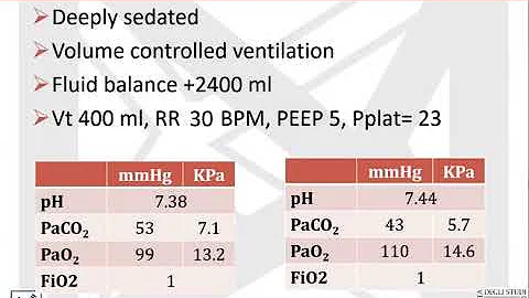 The ABC of ARDS treatment  The basic, case based p...