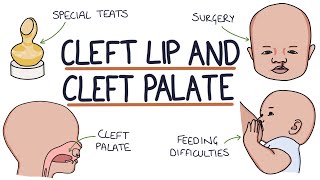 Cleft Lip and Cleft Palate: For Students screenshot 2