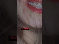 ان جيت با بوسه ستوريات انستا حزينه 