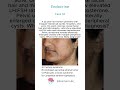 Endocrine - Case 32