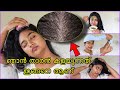 എന്റെ Dandruff Removal ഇങ്ങനെ ആണ് 🔥🔥🔥 How to remove dandruff at home in Malayalam/SimplyMyStyle