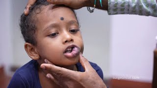 Little Girl with Hemangioma - Before & After Surgery Results