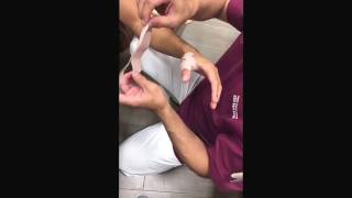 親指のテーピング