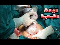شاهد كيف تكون الولادة القيصرية Caesarean Section