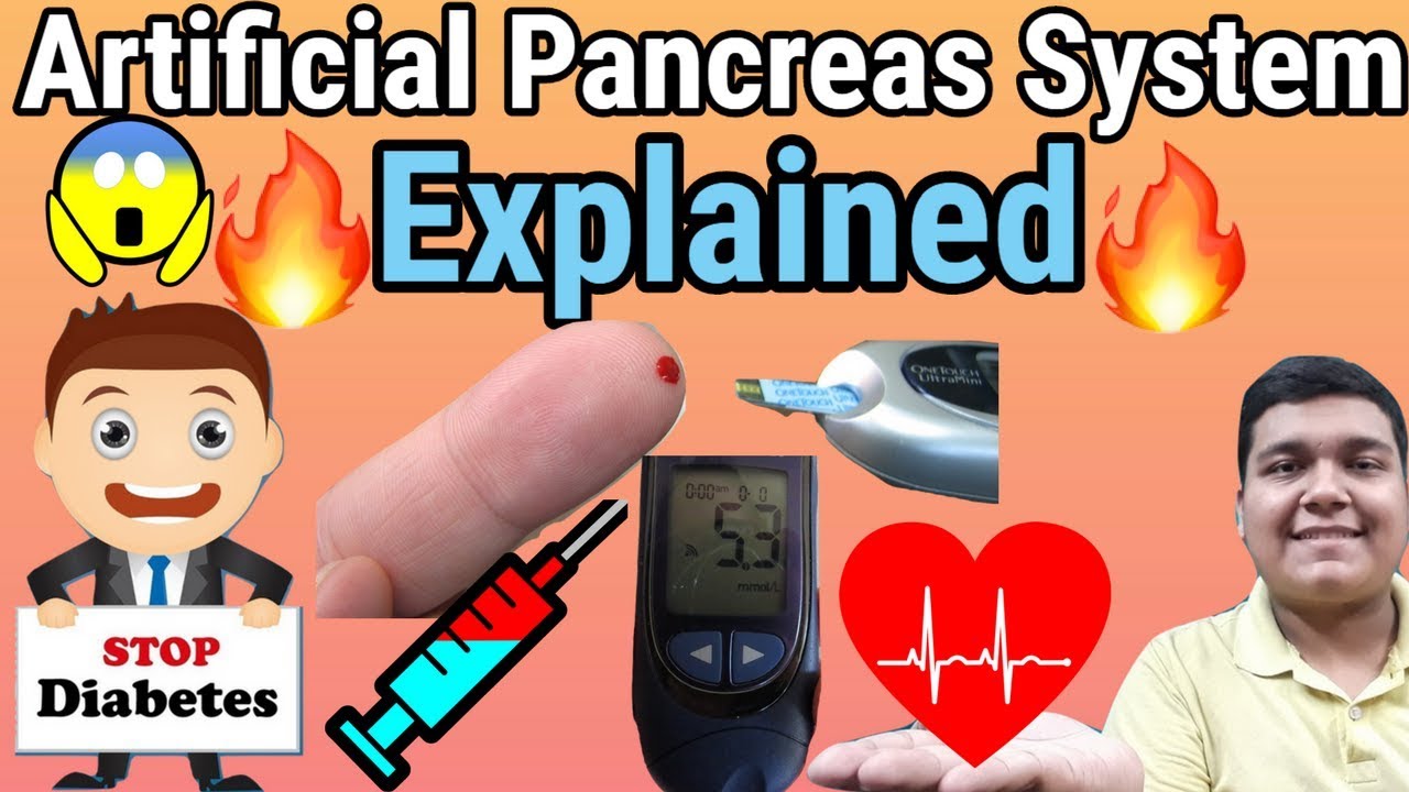 Artificial pancreas system explained How it works? YouTube