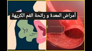 أمراض المعدة و رائحة الفم الكريهة Bad breath Halitosis Mauvaise haleine