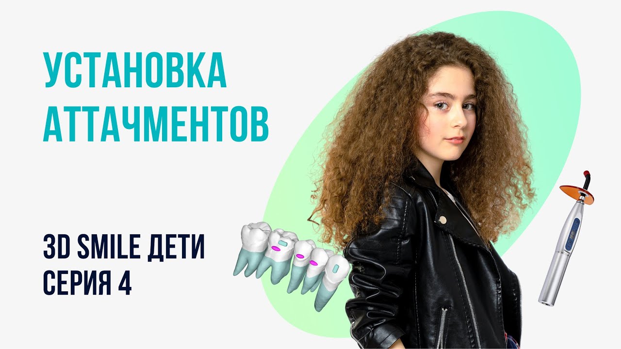 3D SMILE ДЕТИ. СЕРИЯ 4. УСТАНОВКА АТТАЧМЕНТОВ. НОВЫЙ ДЕТСКИЙ КУРС - YouTube