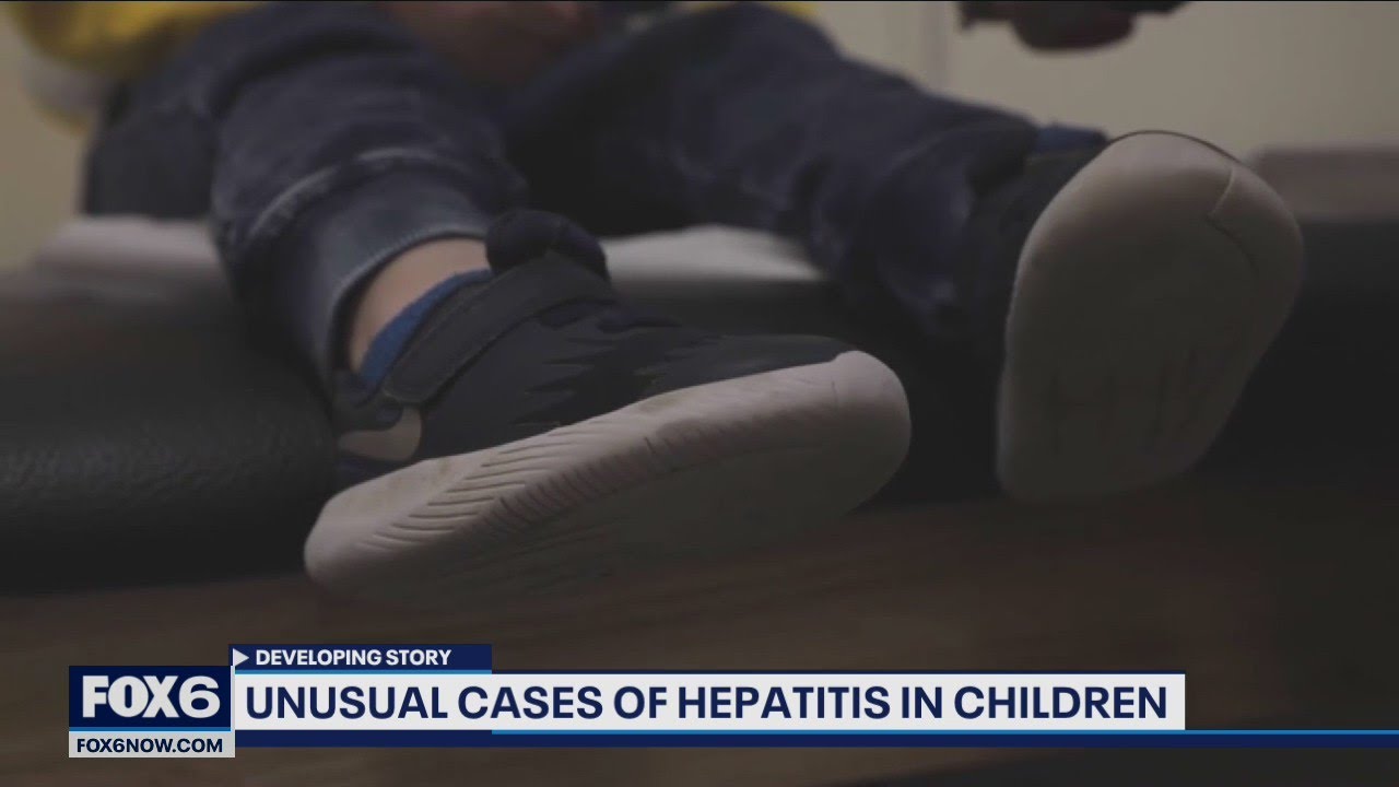 Wisconsin health officials investigate child hepatitis cases | FOX6 News Milwaukee