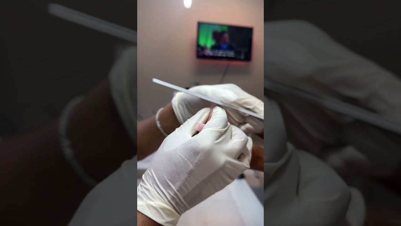 #nails