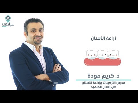 الحشوات التجميلية مع د كريم فودة دكتور أسنان بالمعادي