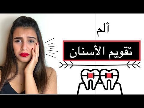 تقويم الاسنان | طرق لتخفيف ألم تقويم الاسنان 😁