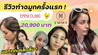 รีวิวการทำจมูกครั้งแรกที่ Emma clinic แบบ close พร้อมบอกทุกเคล็ดลับการดูแลจมูกจากพยาบาล 2023