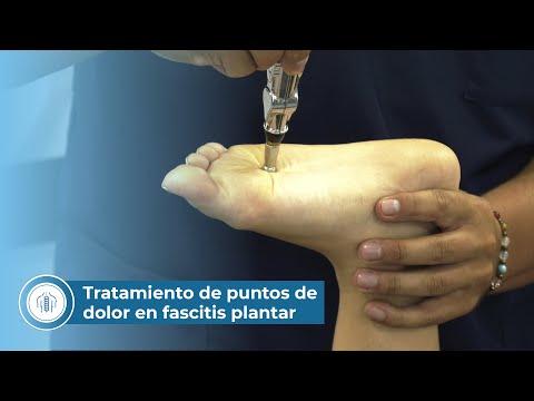 Tratamiento de puntos de dolor en fascitis plantar