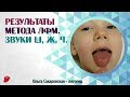 Паретическая форма дизартрии. Результаты Метода ЛФМ. Звуки Ш, Ж, Ч