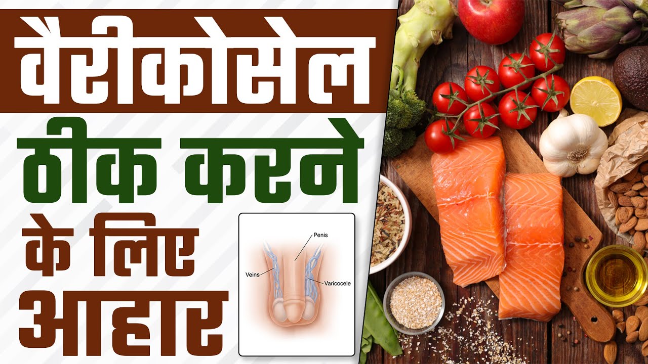 वैरीकोसेल ठीक करने के लिए आहार | Foods For Varicocele Pain Relief | Dr. Health