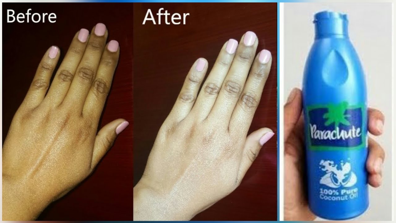 Permanent Skin Whitening with Coconut Oil