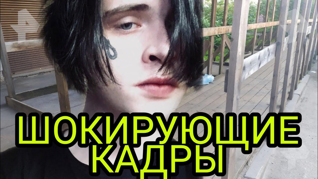 Синдром восьмиклассника обложки альбомов. Синдром восьмиклассника кастом. Синдром аосьмиклас ника 2304. Синдром восьмиклассника альберт. Синдром восьмиклассника симптомы.