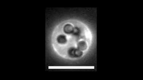 S6: Passive Janus particle in vesicle